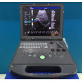планшетный ультразвуковой допплерографии цене и 4D ультразвуковой аппарат для беременных